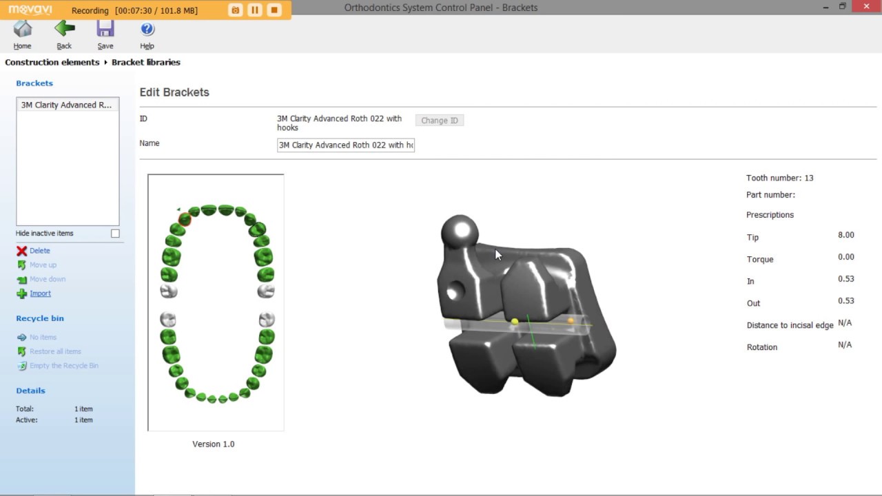 How to Configure Construction Elements in 3Shape Ortho System