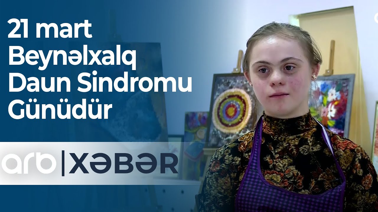 21 mart - Beynəlxalq Daun Sindromu Günüdür  – ARB Xəbər