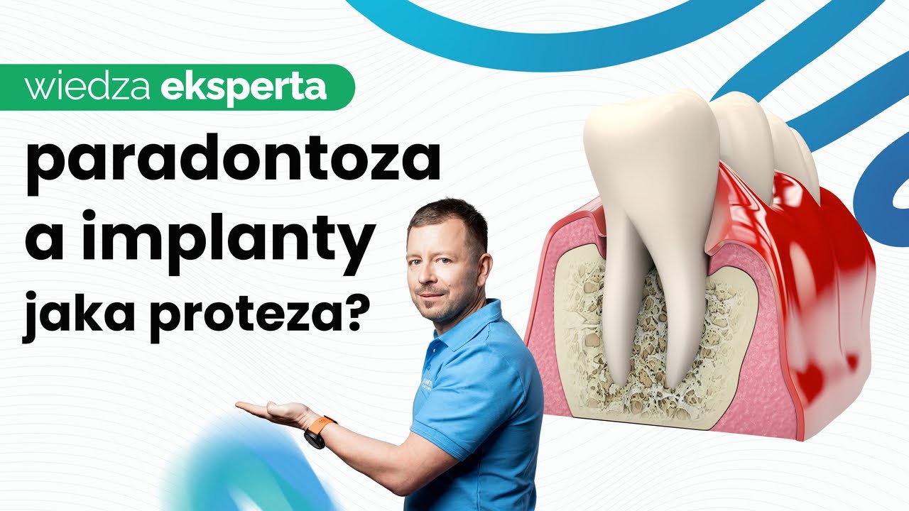 JAKIE PROTEZY PRZY PARADONTOZIE? PIĘKNY UŚMIECH Z ZAPALENIEM PRZYZĘBIA