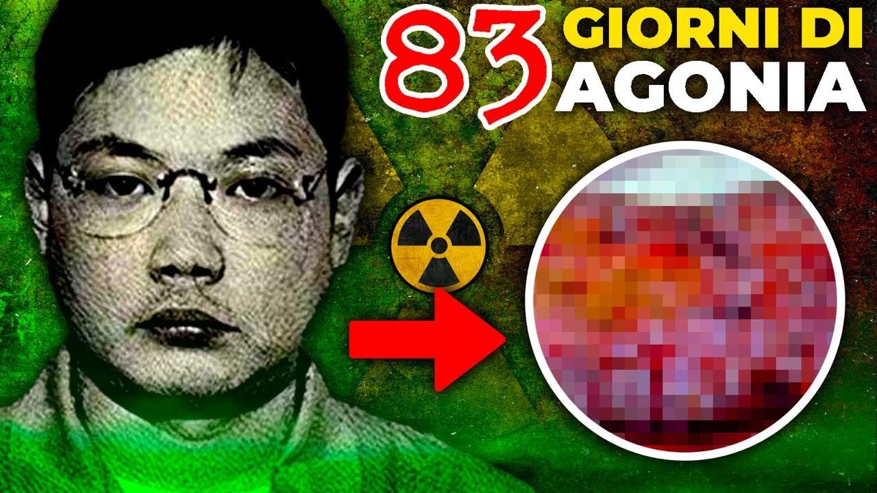 Vivere in un Corpo DECEDUT0 Per 83 Giorni (La M0rte PEGGIORE di Sempre)