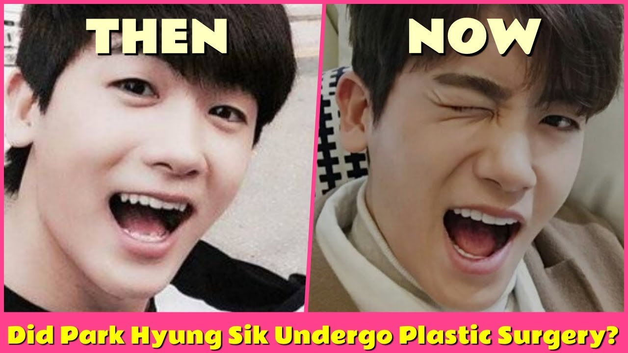 Did Park Hyung Sik Undergo Plastic Surgery?