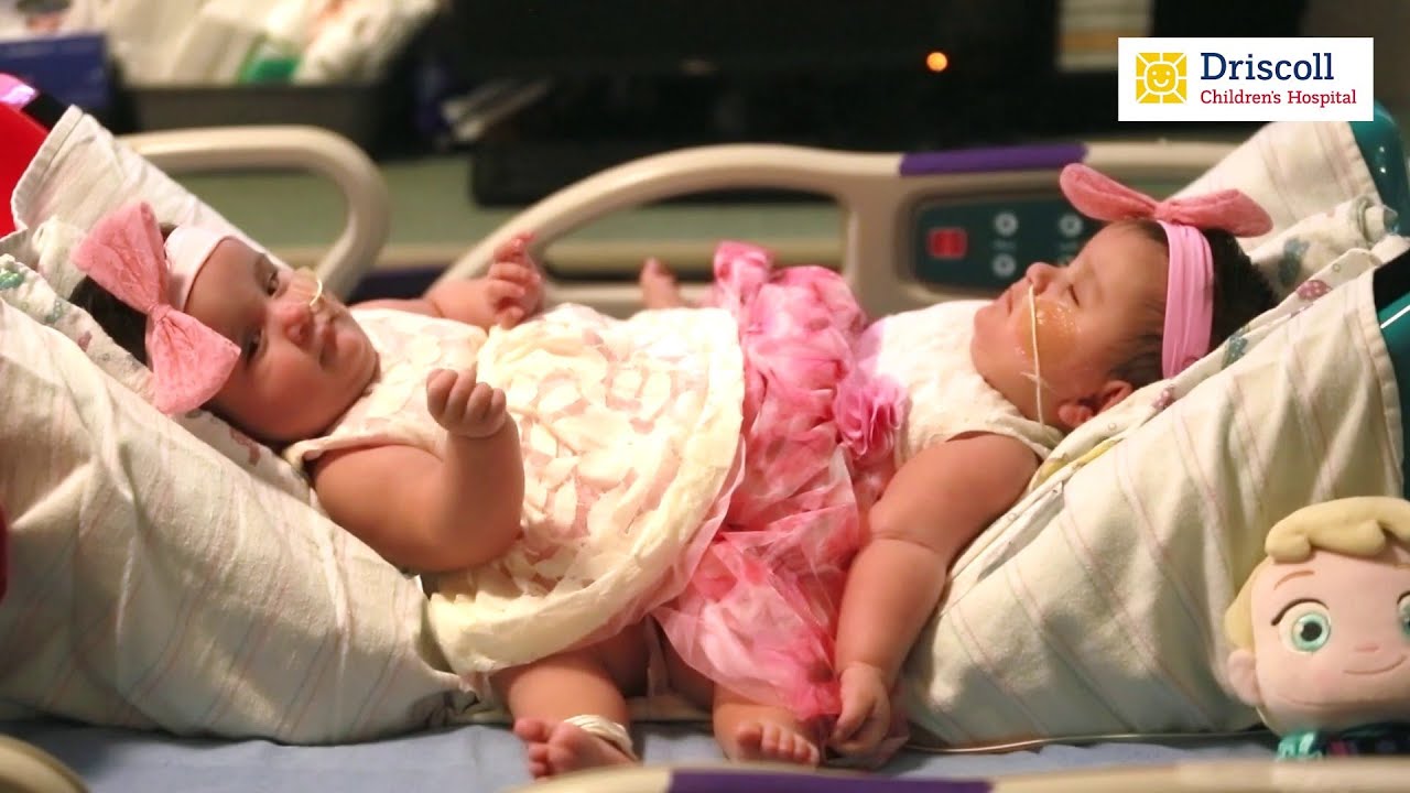Formerly conjoined twins in South Texas still closer than ever 5 years after separation surgery