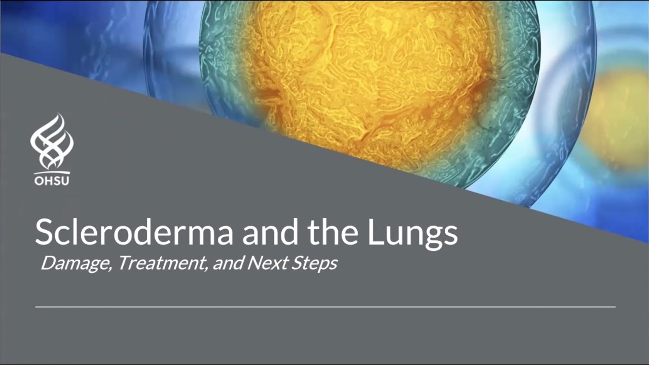 2022 Scleroderma and the Lungs - Dr. Daniel Seifer and Dr. Jeffrey Robinson