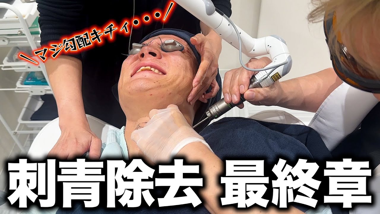 タトゥー除去動画は今後一切出しません。