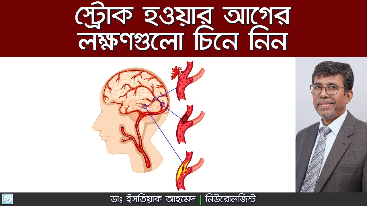 ১ মিনিটে স্ট্রোক চেনার উপায় ও লক্ষণ | Stroke Symptoms in Bengali