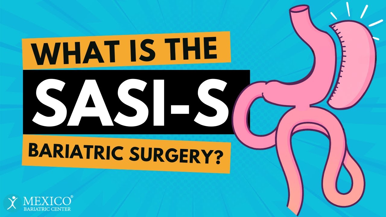 What is SASi-S Bariatric Surgery?