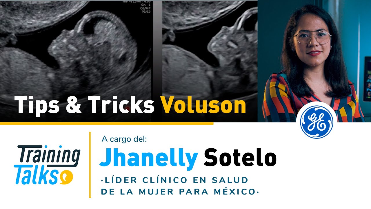 Tips & Tricks para optimizar la imagen 2D de tu Voluson ⭐