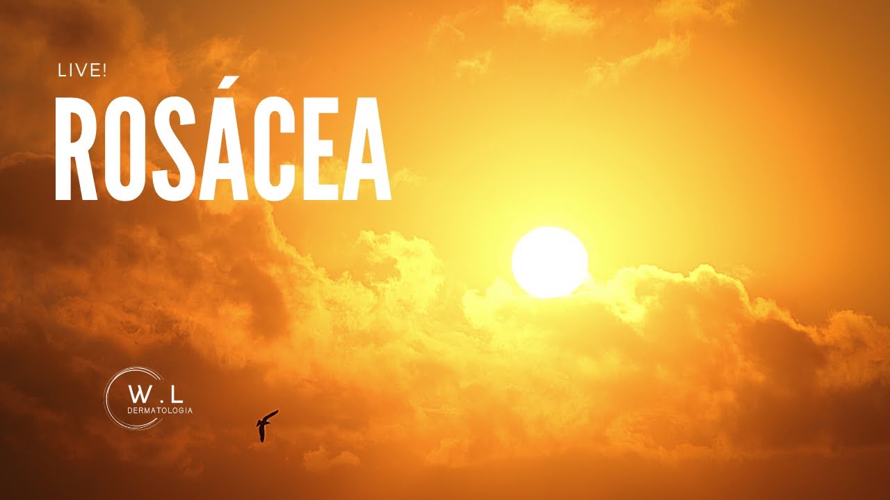 Rosácea - Conceitos gerais, algumas novidades, tratamento e pergunta e respostas
