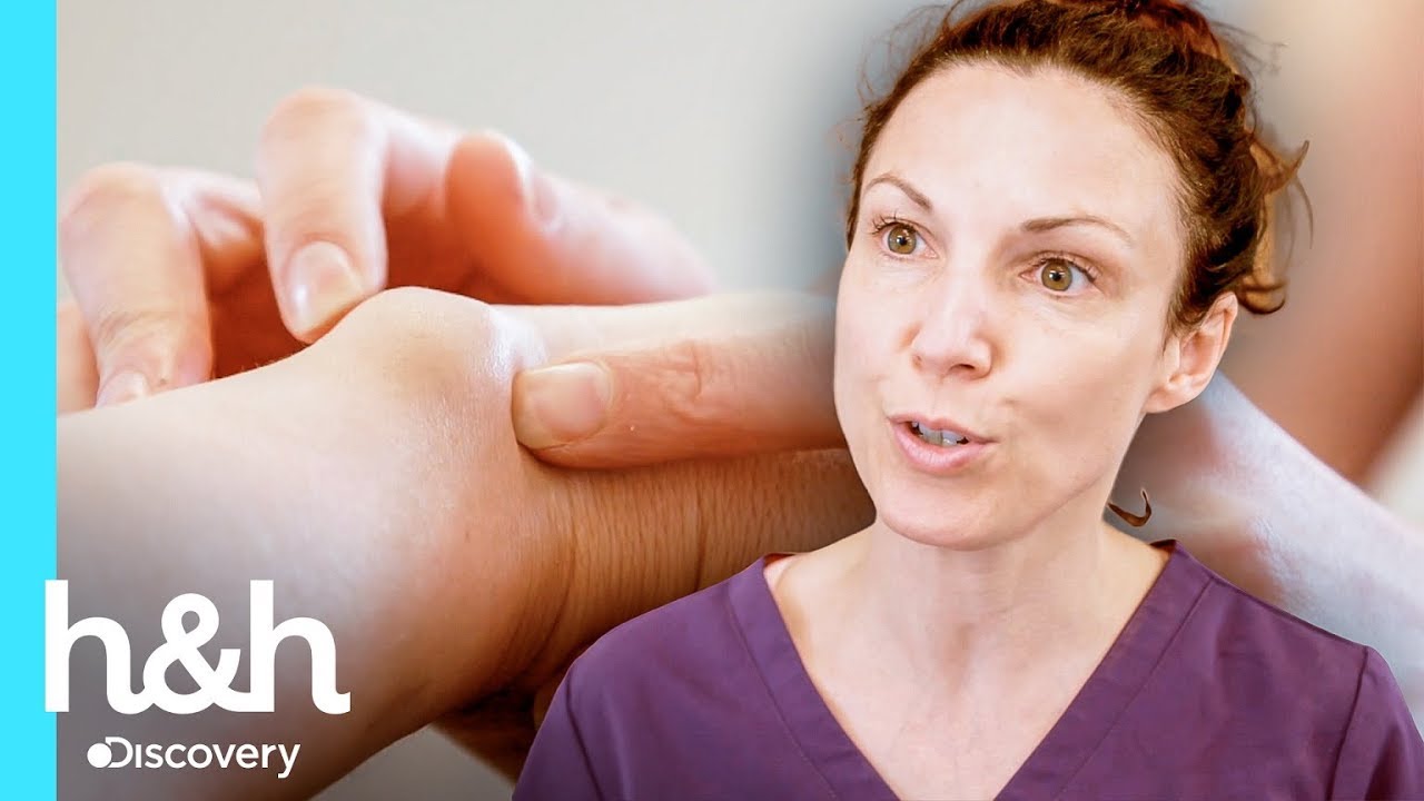 Cirurgia geral para remover um nódulo na mão | Dra. Emma: Uma Questão de Pele | Discovery H&H Brasil