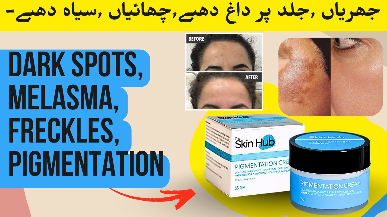 Best Pigmentation Cream | داغ دھبوں کا مکمل خاتمہ | The Skin Hub