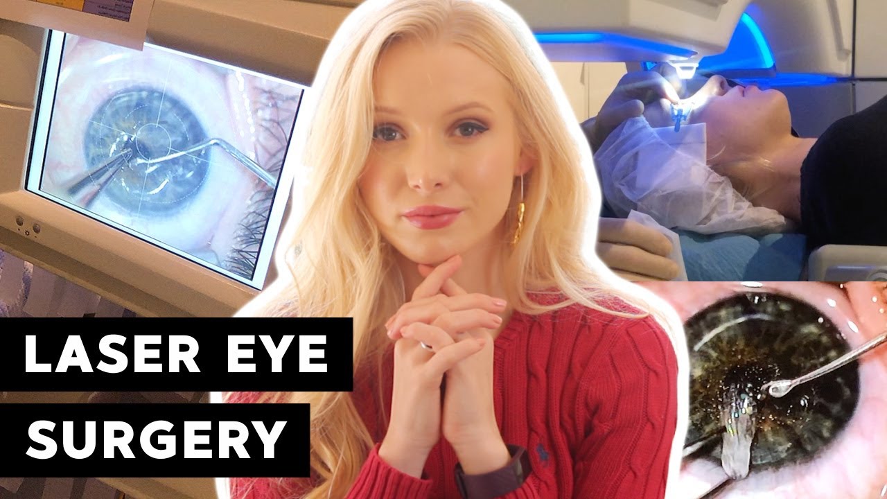 What getting laser eye surgery is really like - From Astigmatism to 