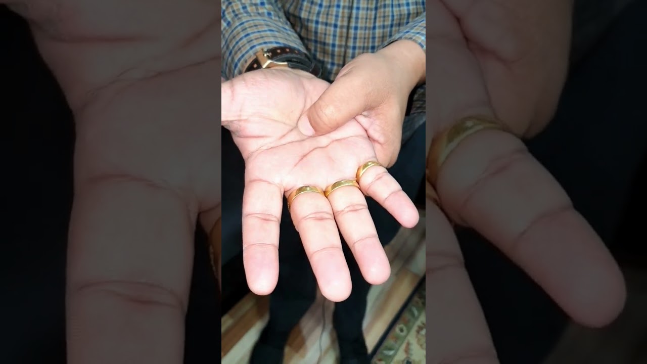 Single acupressure point for chronic kidney & urine problem @ayaancreatives