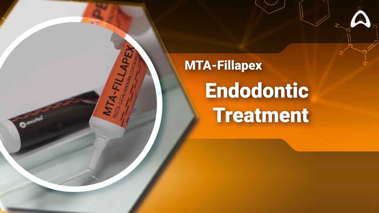 MTA-Fillapex - Endodontic treatment