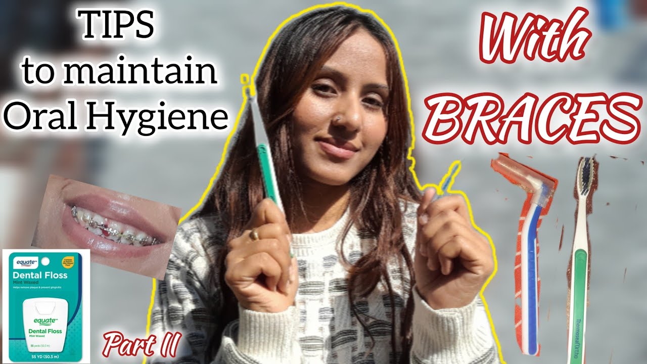 Braces Oral Hygiene Tips | Avoid Cavities & Bad Breath /mybracesjourney #braces #bracesjourney 