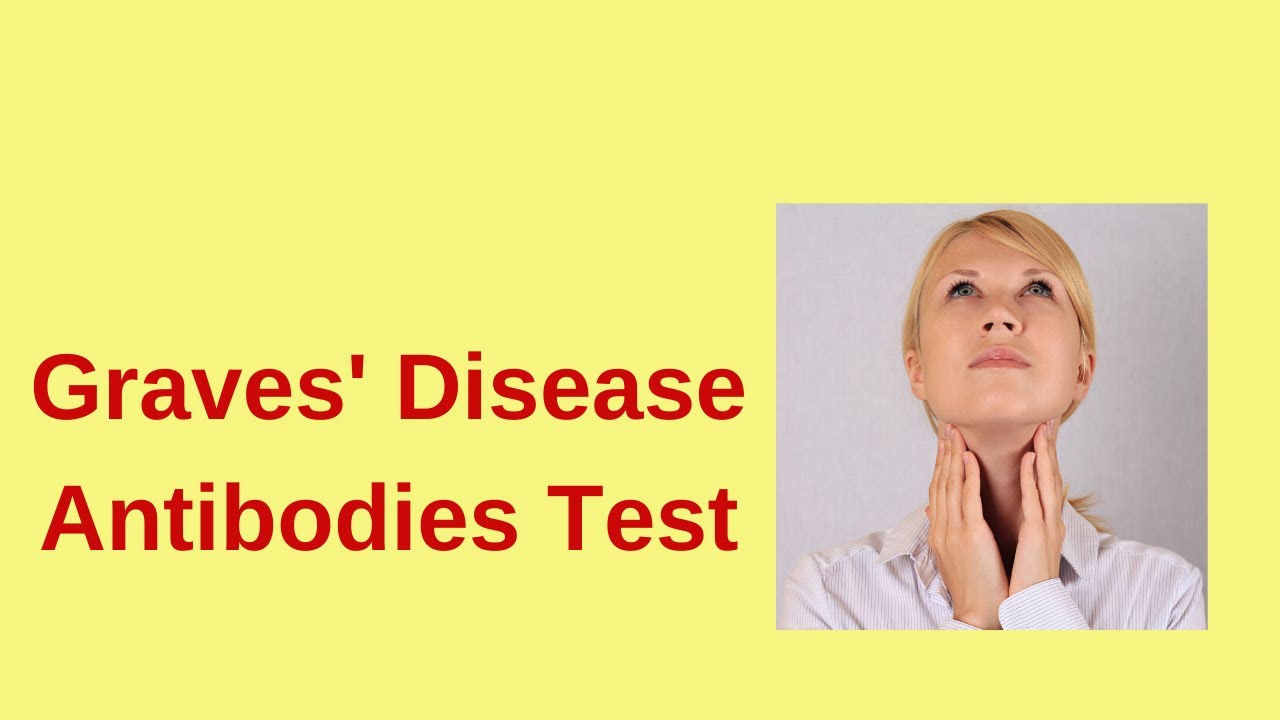 Thyroid stimulating immunoglobulins (TSI) in Graves' Disease