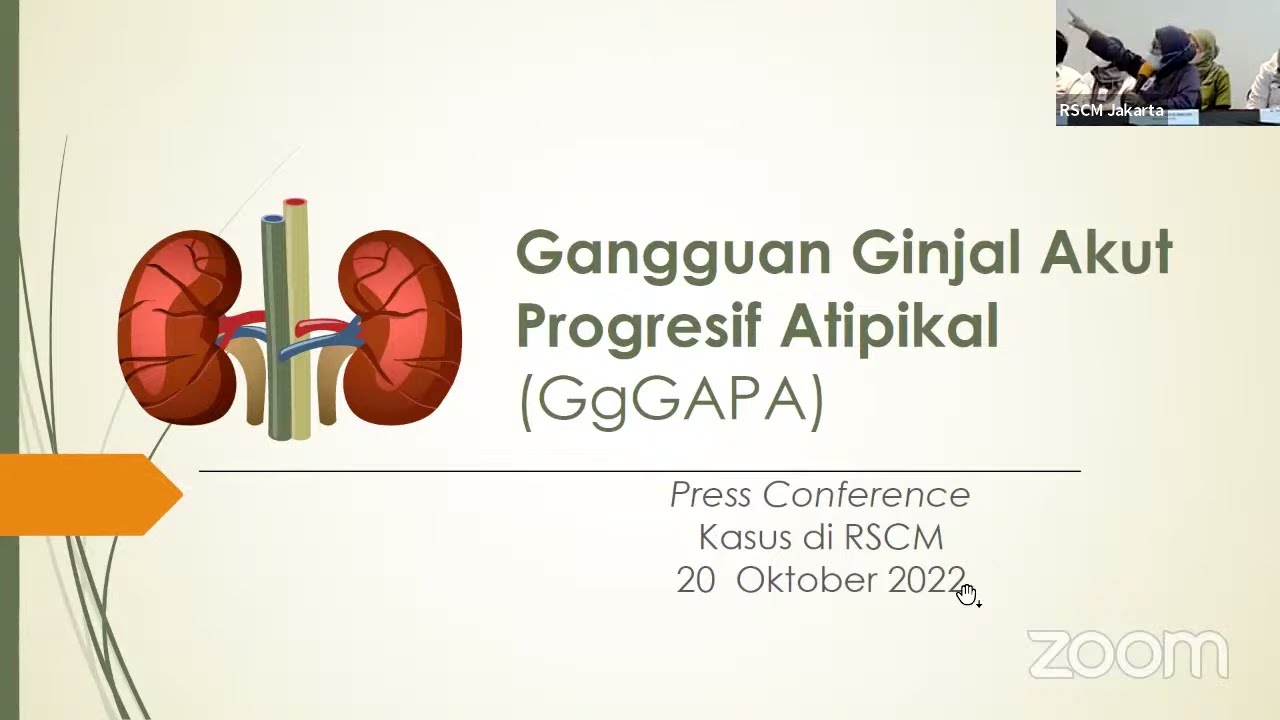 Press Conference RSUPN dr. Cipto Mangunkusumo: Gangguan Ginjal Akut Progresif Atipikal (GgGAPA)