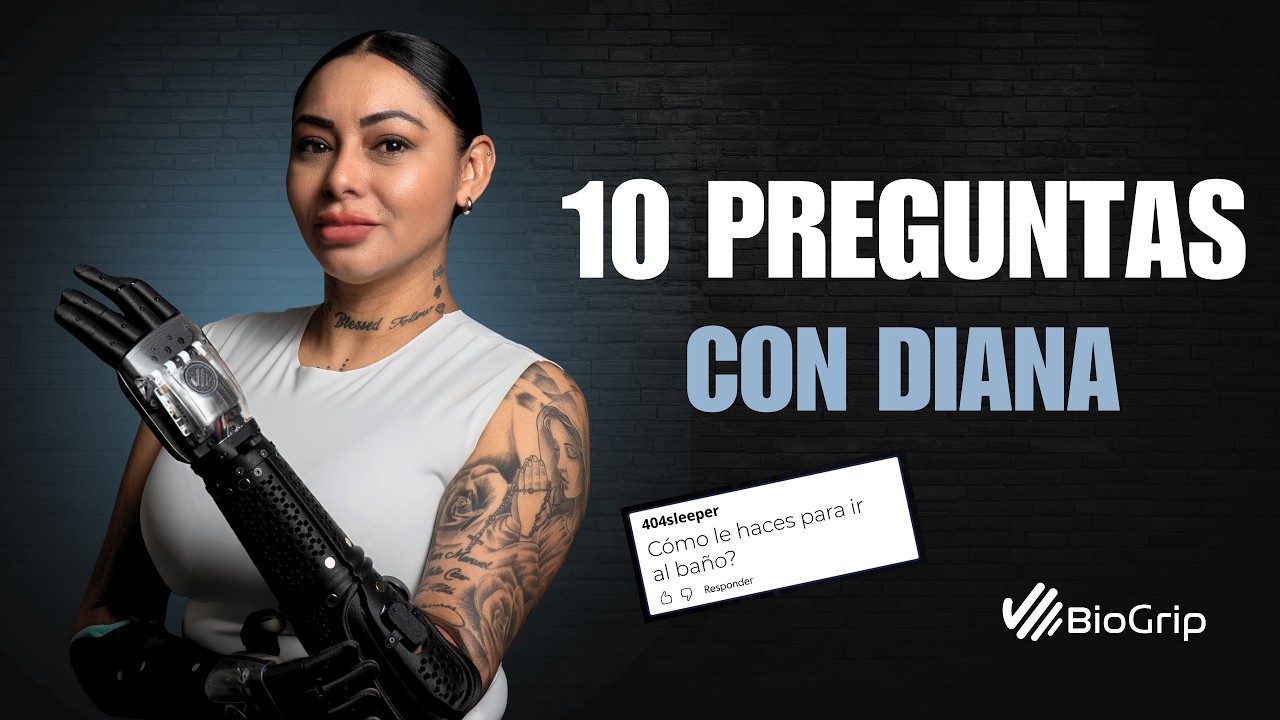 10 Preguntas que Me Hacen por Mis Brazos Biónicos