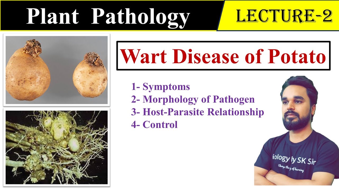 Wart Disease of Potato | Plant Pathology | SK Sir