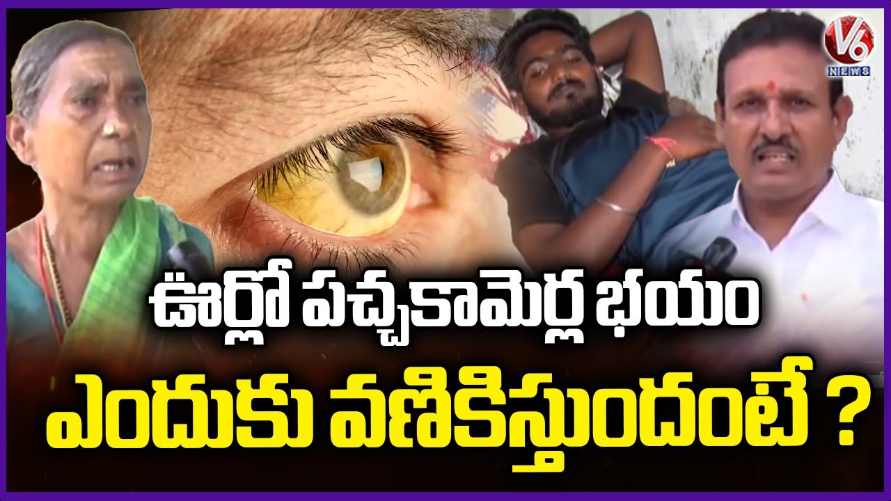 Jaundice Terrifies Residents of Bethigal Village | Karimnagar | Ground Report | V6 News