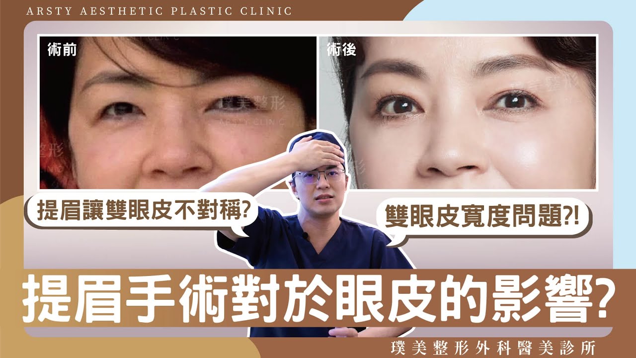 提眉造成雙眼皮不對稱？內視鏡提眉對於雙眼皮有甚麼影響，是否可以改善提眼肌無力的問題？
