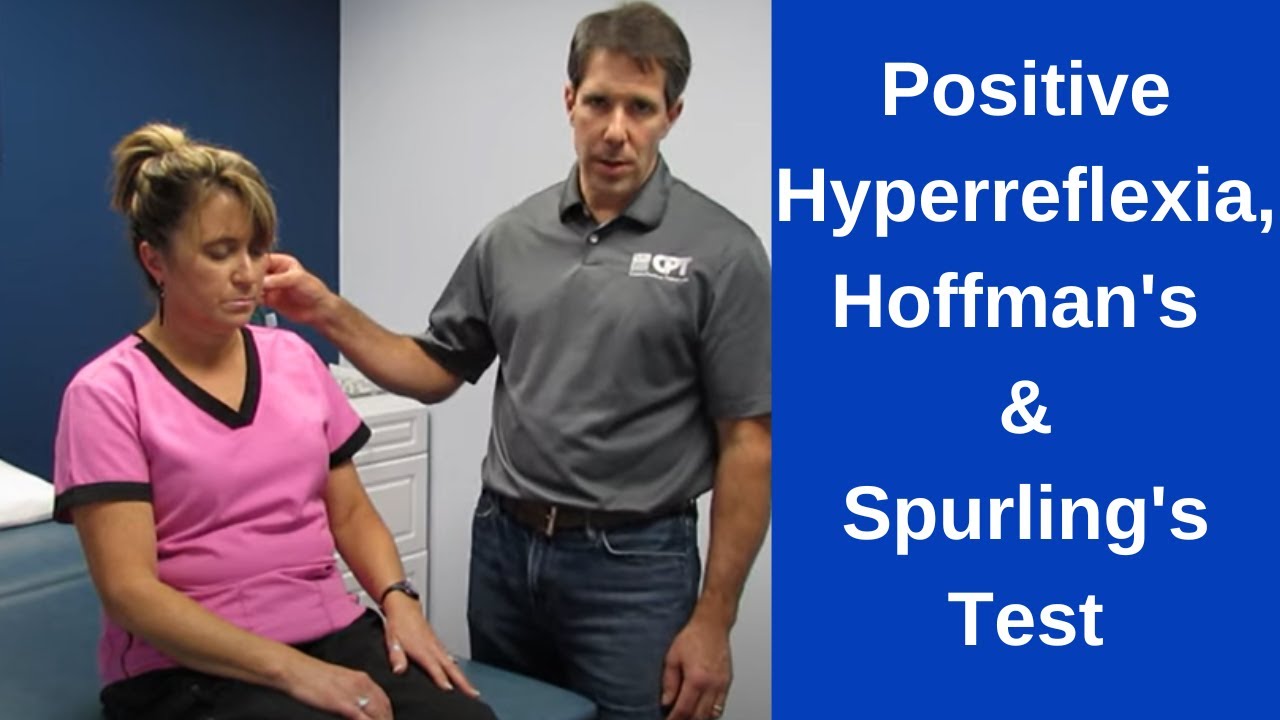 Positive Hoffman's Sign,  Hyperreflexia and Spurling's Test