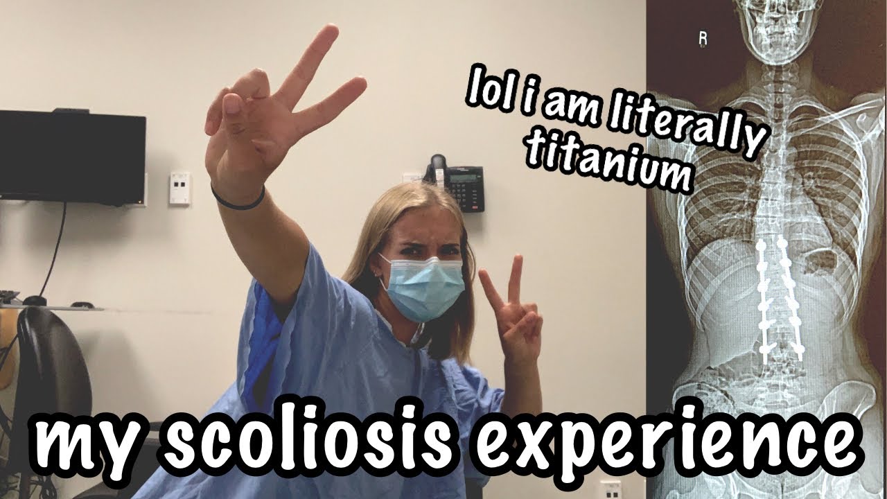 I've Waited 5 Years to Share This | MY SCOLIOSIS STORY | maddy a