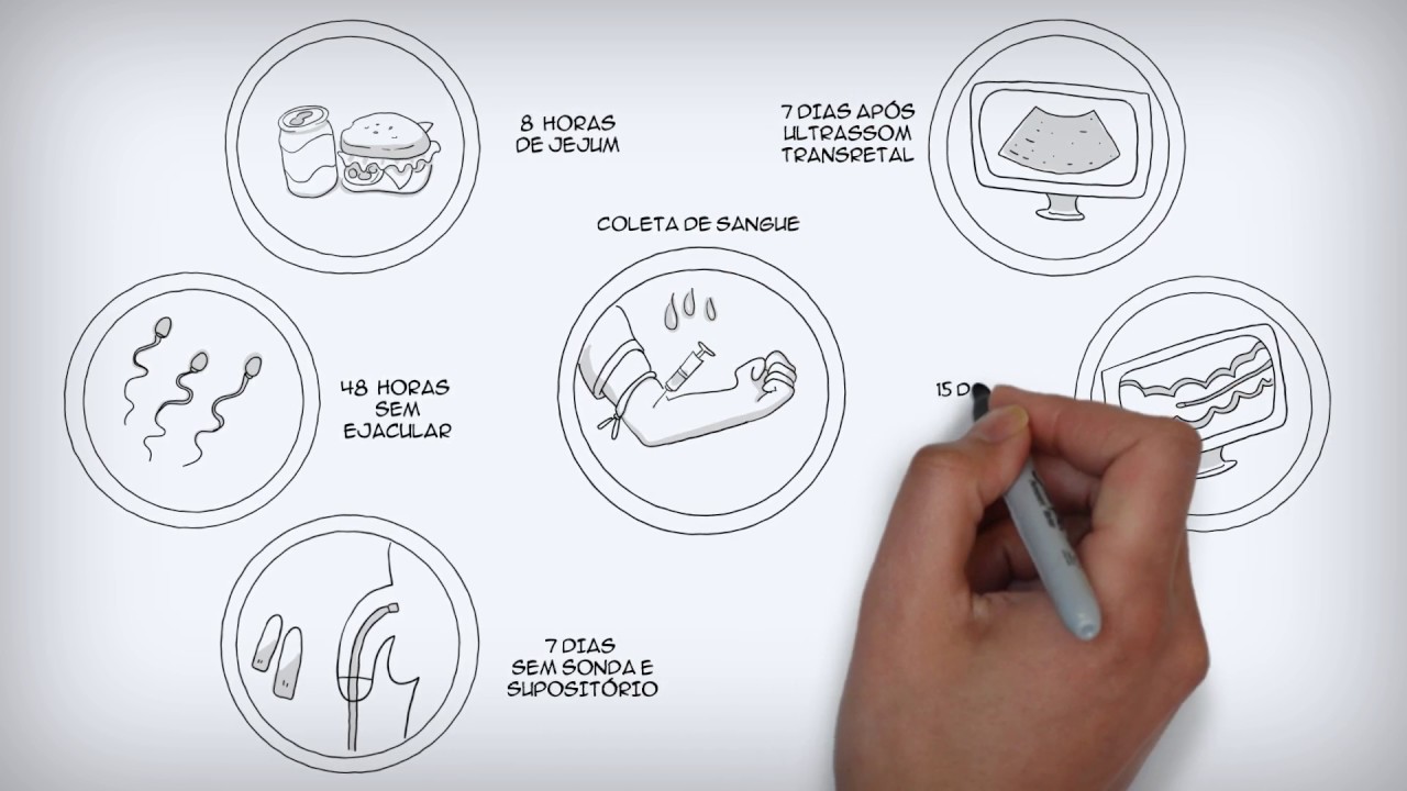 Exame de Pr&oacute;stata - PSA