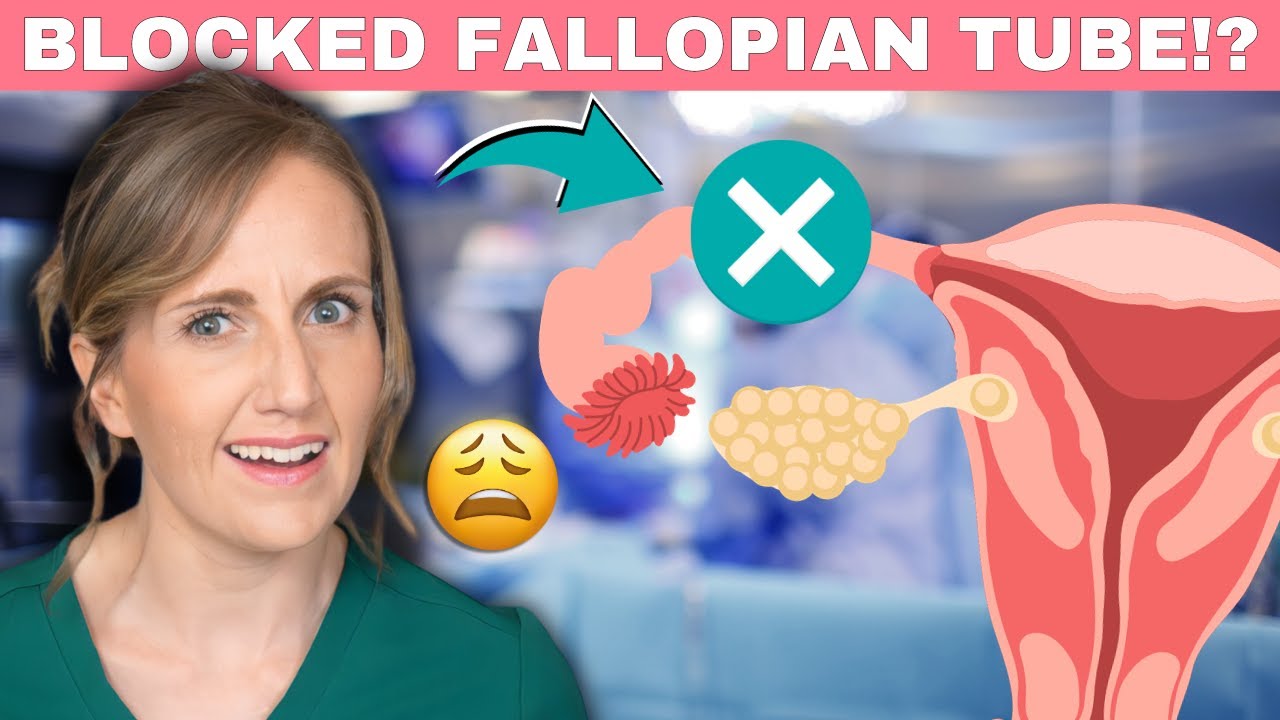 What can cause blocked fallopian tubes?