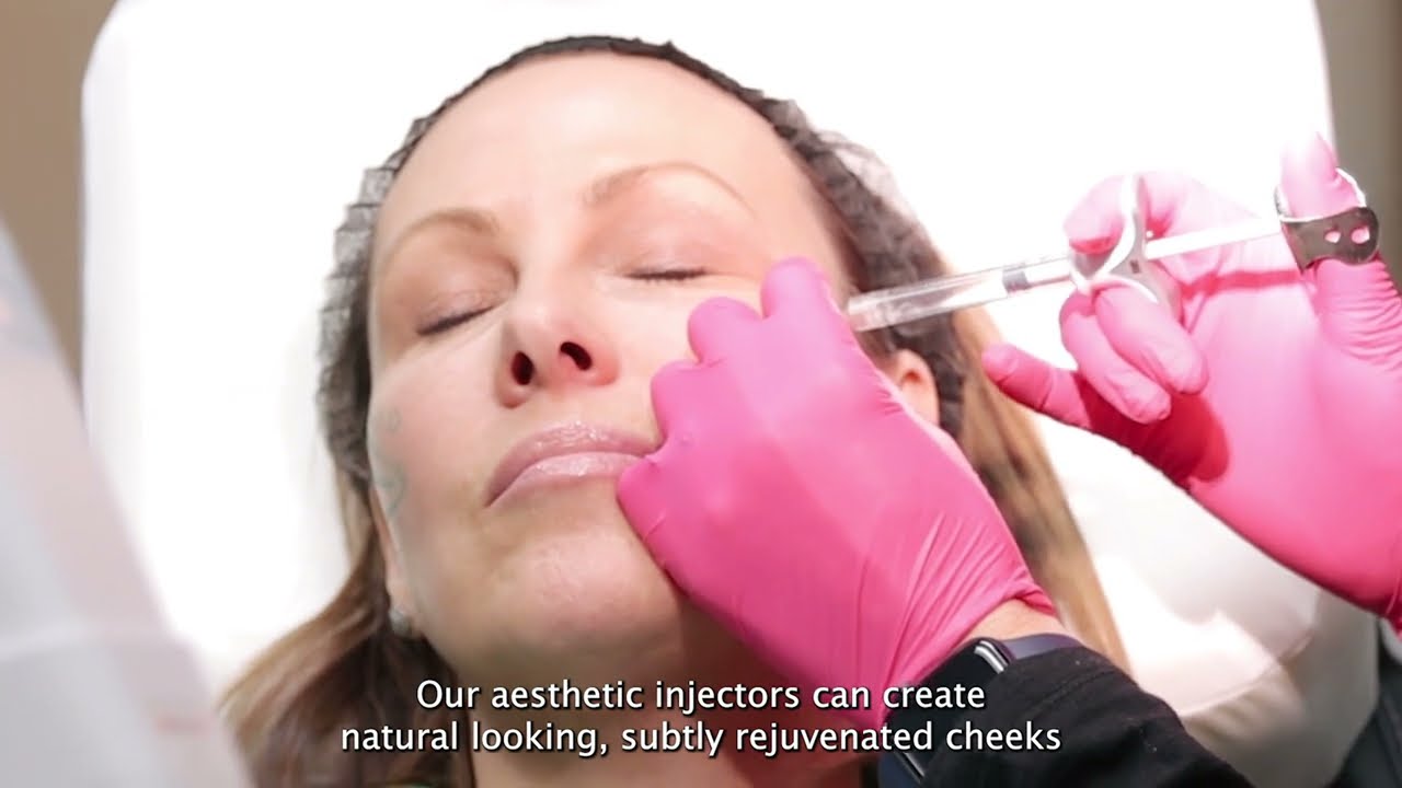 Mid-face dermal fillers at ReFresh Aesthetic Center™