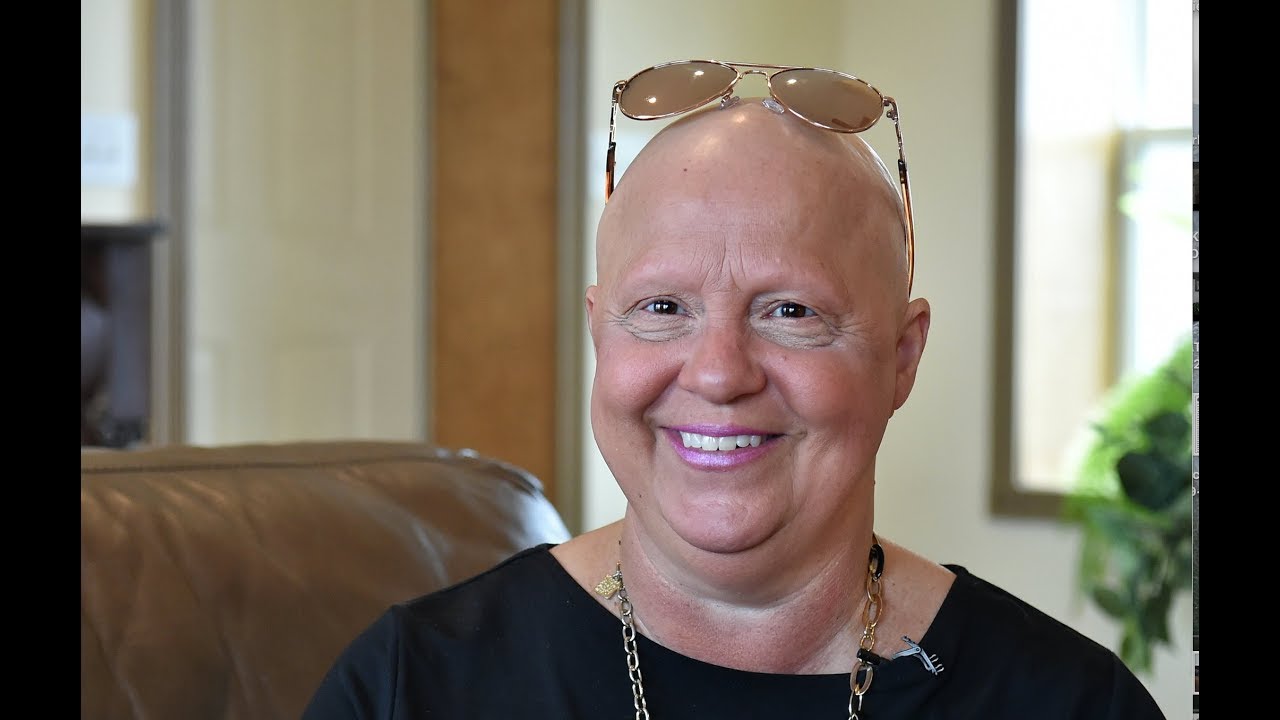 Life with alopecia: When women lose their hair