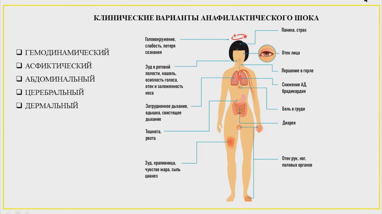 Сестринская помощь при анафилактическом шоке