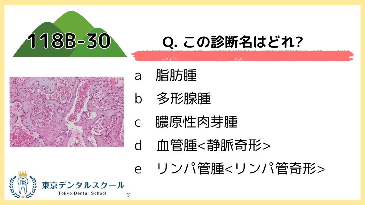 赤血球を見抜け！血管腫の診断ポイント【歯科国試対策】118B30