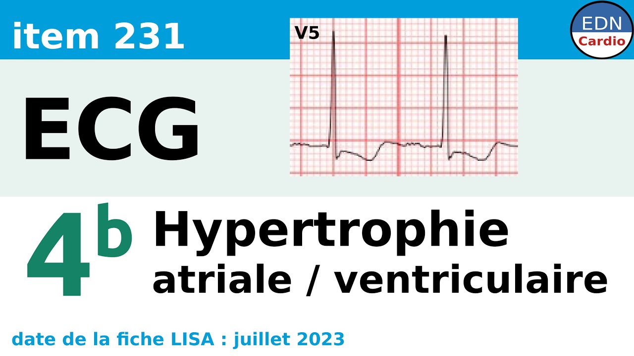 231 - Electrocardiogramme (ECG) - Partie 4b - Hypertrophie atriale et ventriculaire