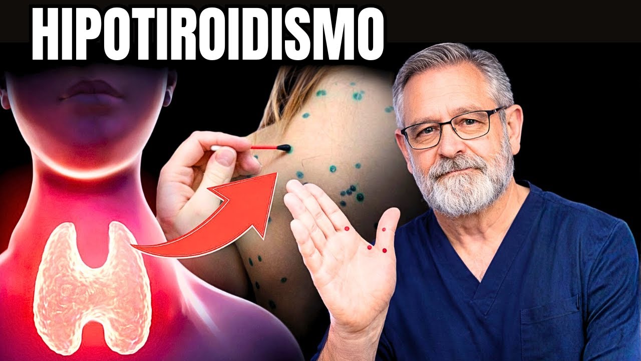 Como médico cardiólogo, TE LO IMPLORO: Hipotiroidismo y Triglicéridos alto son un RIESGO en 50+