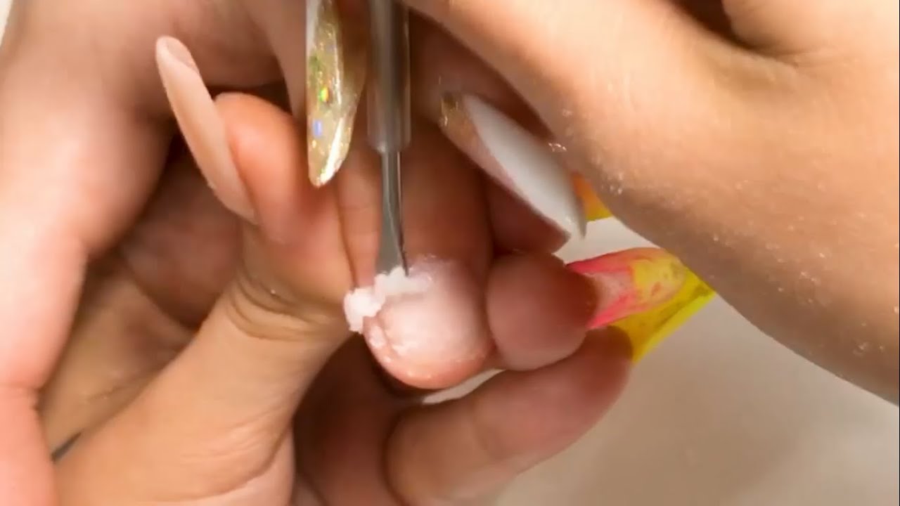 Como fazer a Remoção de um Banho Acrílico de forma rápida e segura!