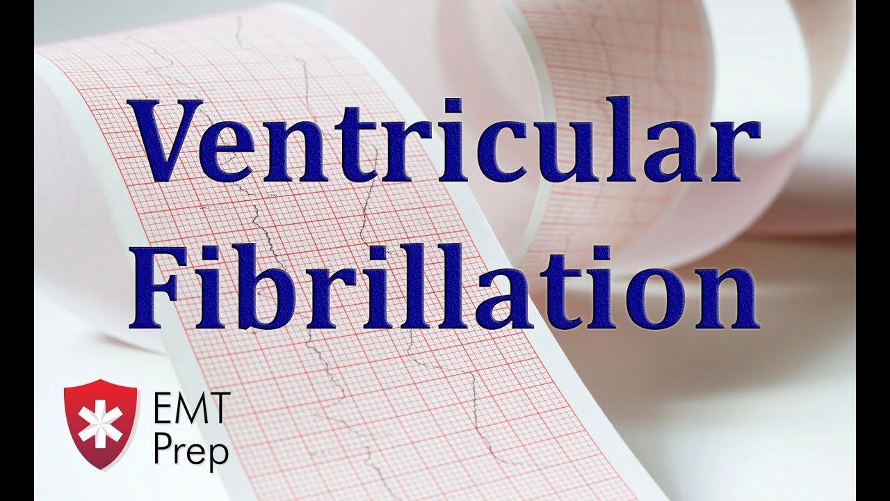 Ventricular Fibrillation ECG - EMTprep.com