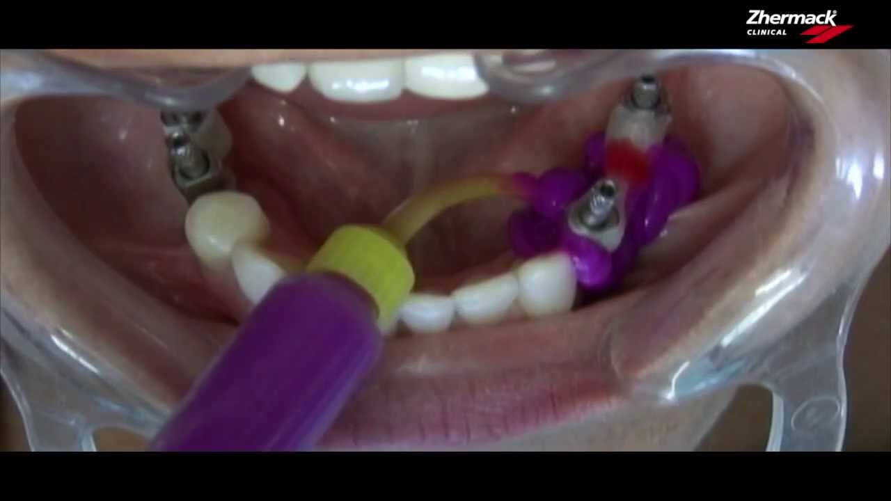 Hydrorise Video ENG - monophase impression
