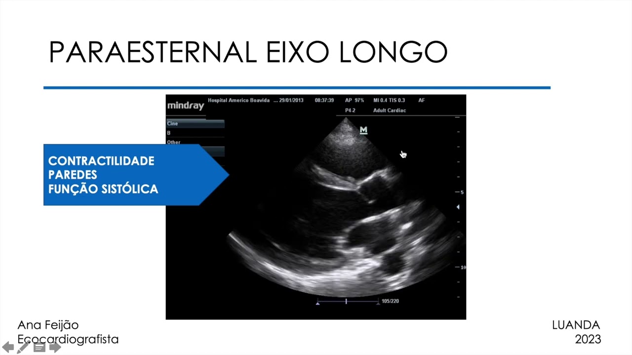 Ecocardiograma Transtorácico passo a passo