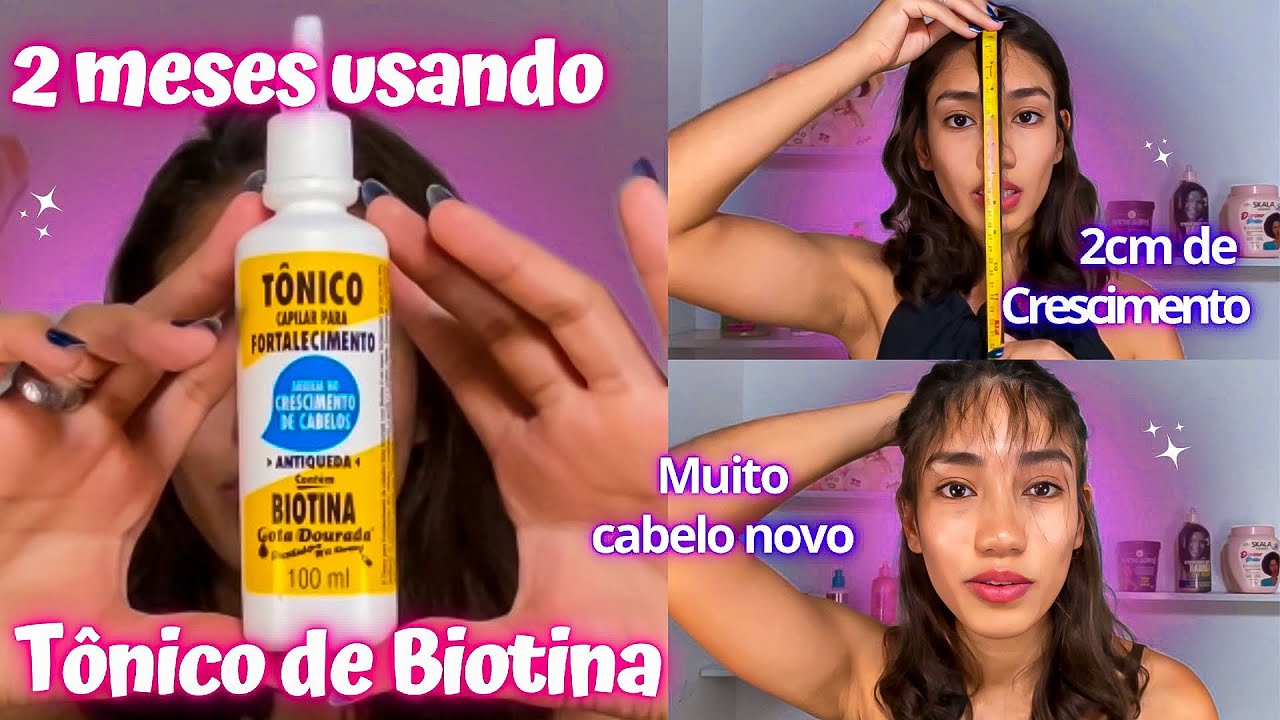2 MESES USANDO TÔNICO DE BIOTINA GOTA DOURADA  ( tô com muito cabelo novo )