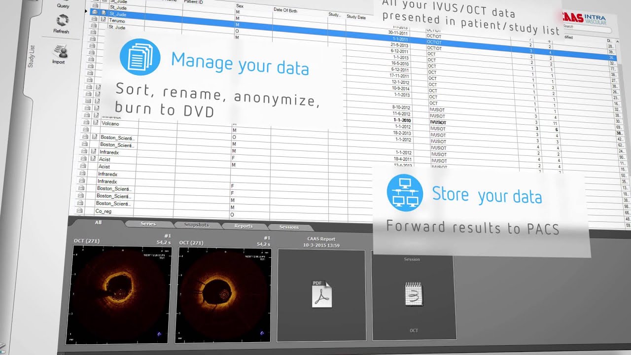 CAAS IntraVascular: for analysis of IVUS, NIRS-IVUS and OCT images