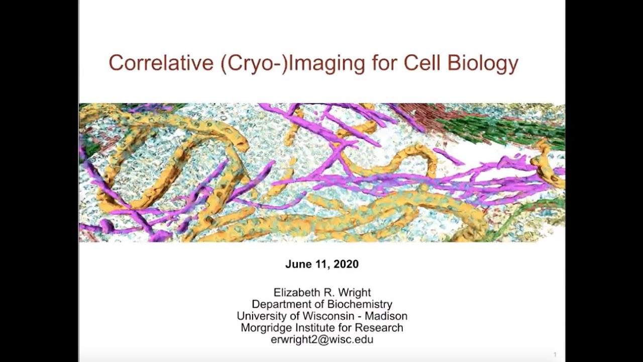 Cryo-CLEM webinar series: No1 - Correlative (cryo-)microscopy for cell biology