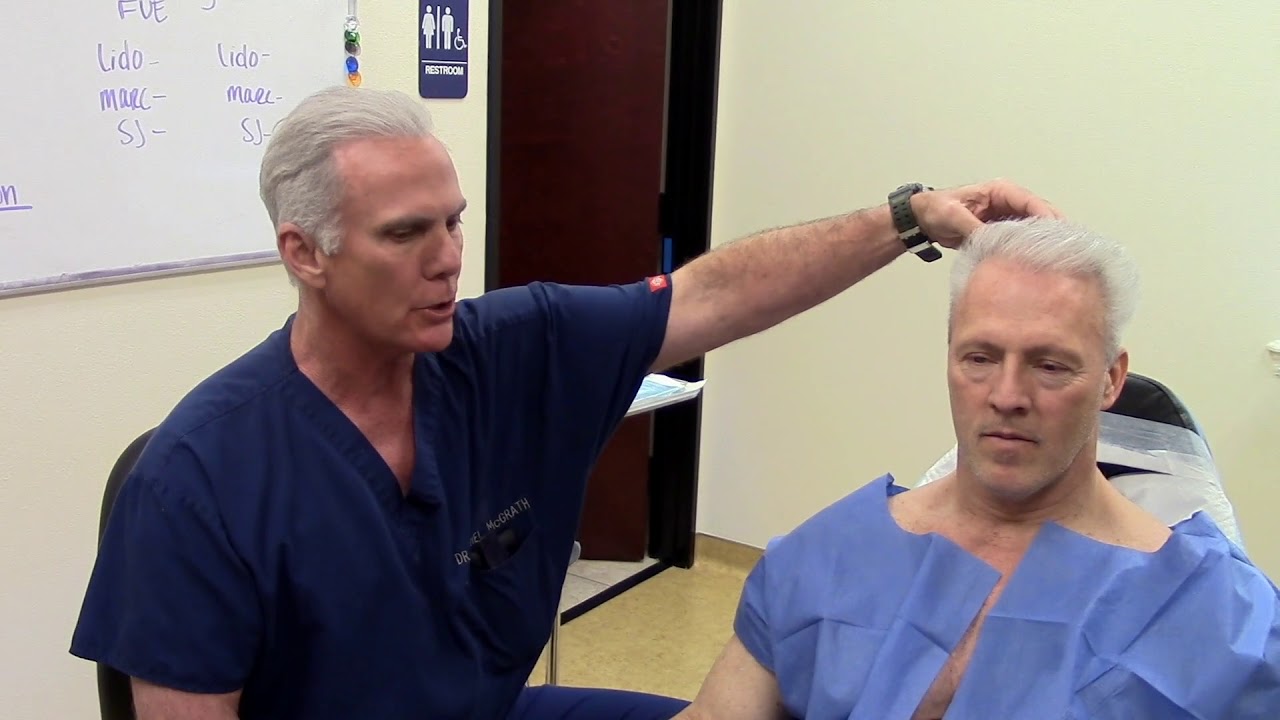 Body Hair Transplant to Head-  Beard Hair FUE Transplant to Scalp