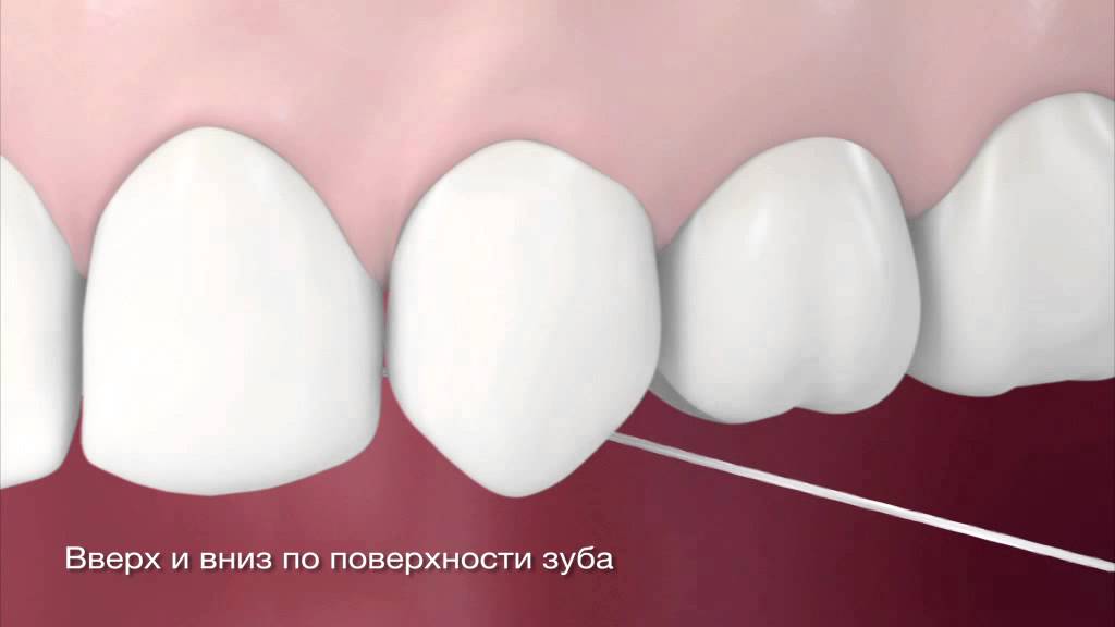 Правильная чистка зубной нитью