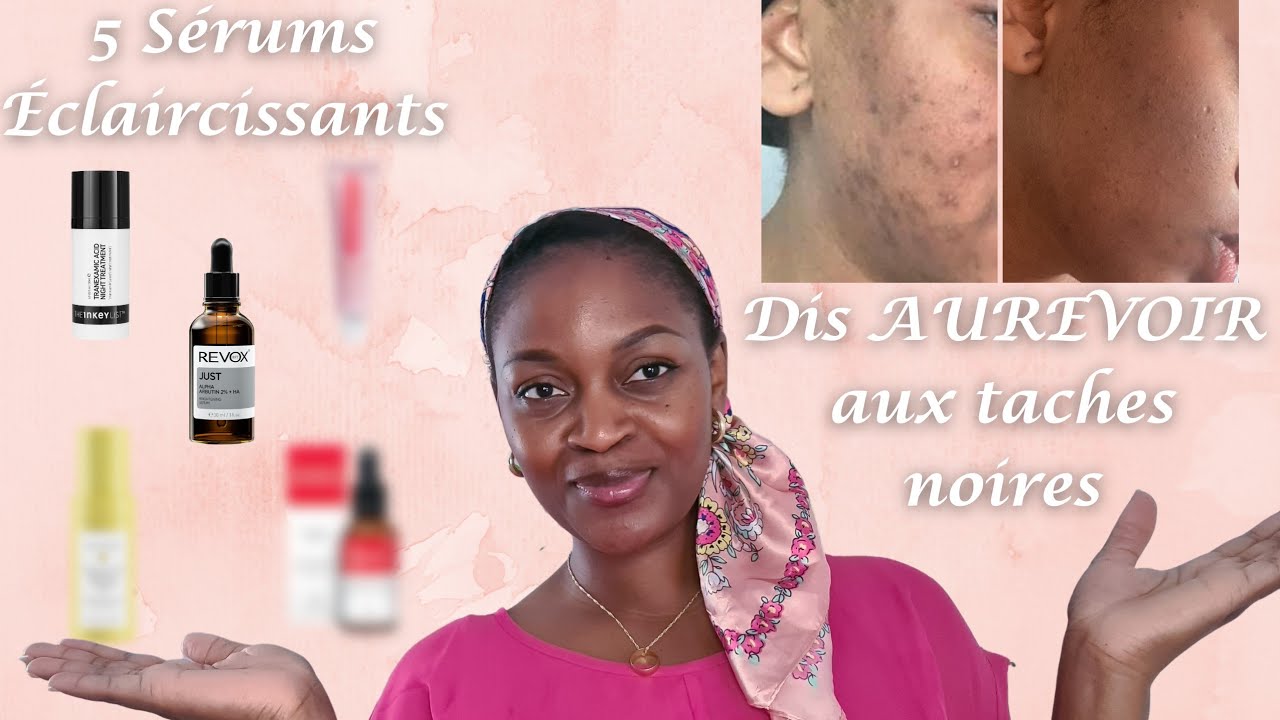 Mon top 5 des meilleurs sérums éclaircissants du marché  | Bye bye l'hyperpigmentation✅