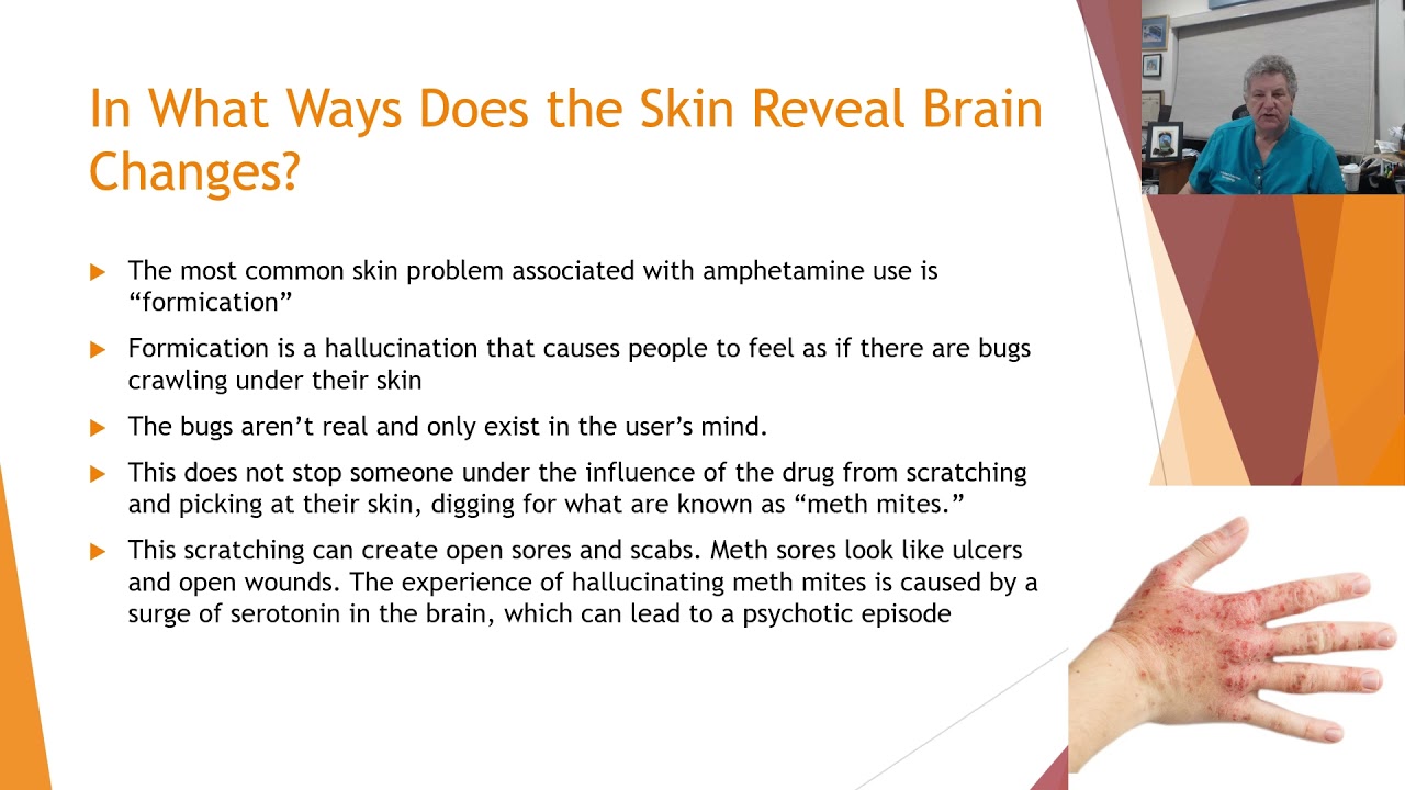 The Brain-Skin Connection Series: 9. In What Ways Does the Skin Reveal Brain Changes?