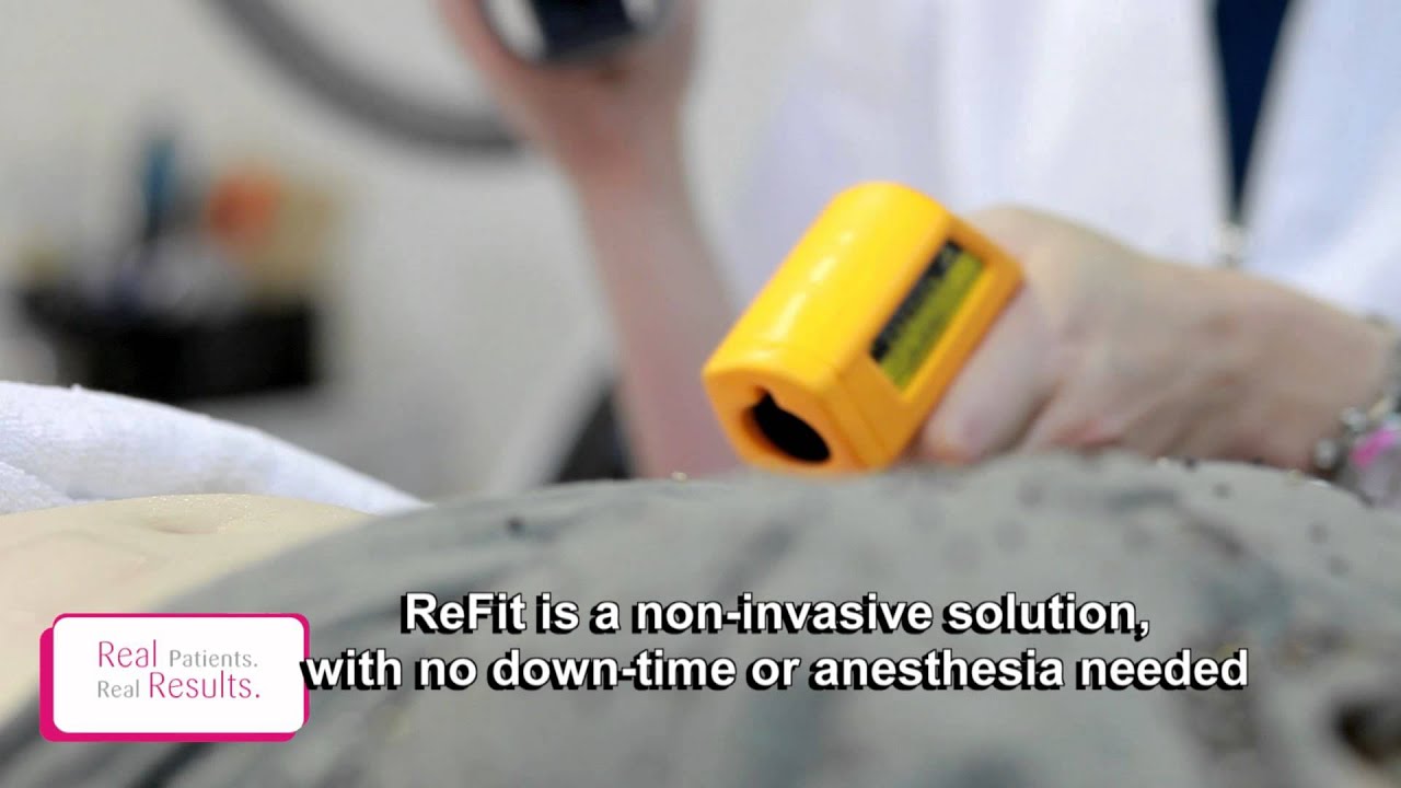 ReFit Patient Testimonial
