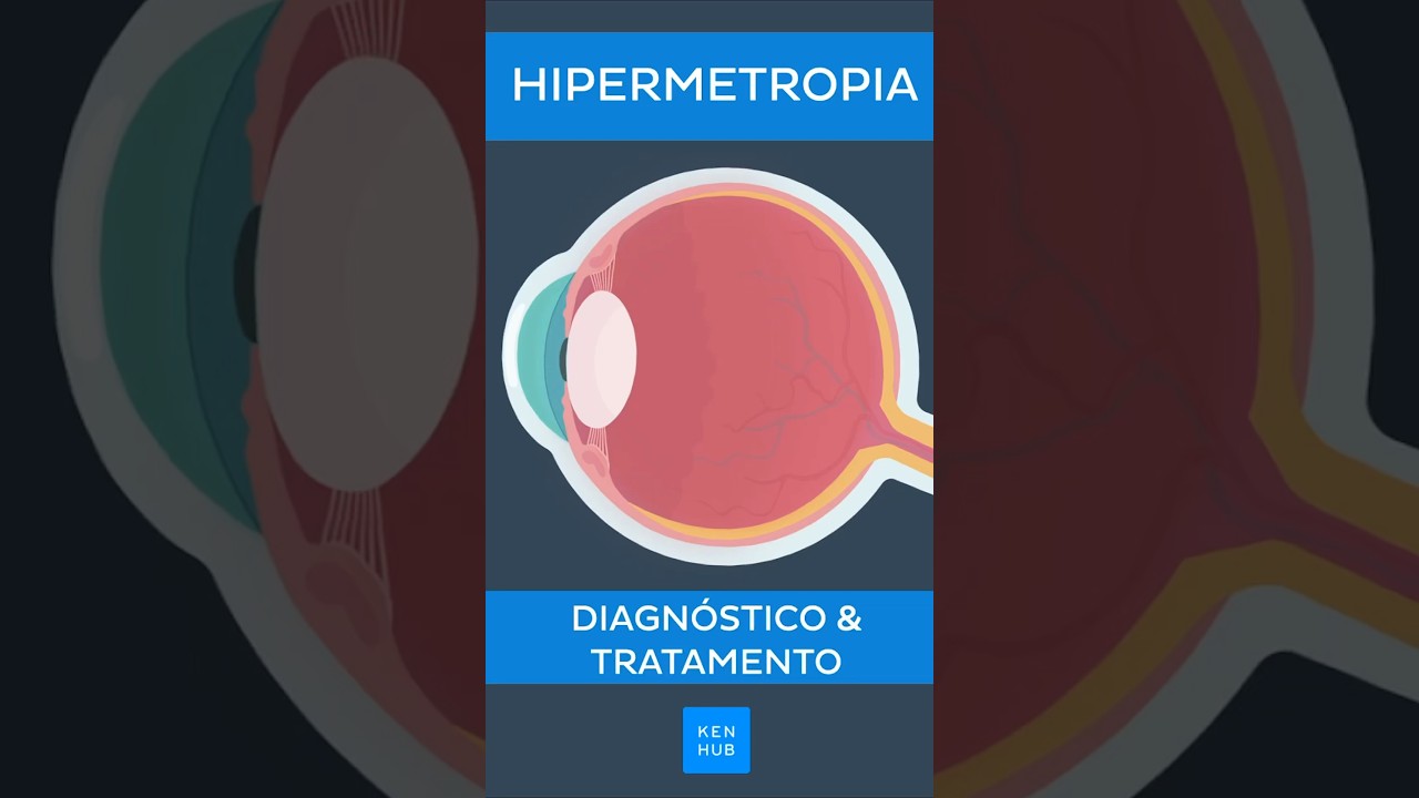 Hipermetropia: Diagn&oacute;stico e tratamento | Kenhub #hipermetropia