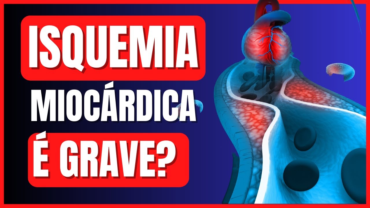 ISQUEMIA MIOCARDICA  ou INSUFICIENCIA CORONARIANA no teste ergométrico É GRAVE? TEM CURA?