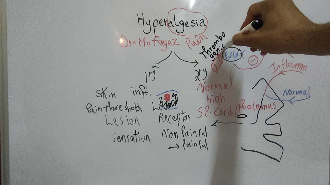 #Sensory_CNS_Dr_Mohamed_Fayez Pain Part 2