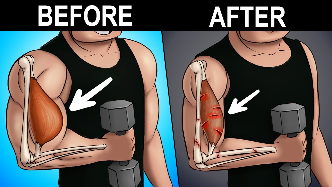 What Happens If You Workout TOO MUCH?
